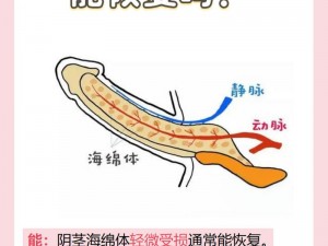 用手过度的海绵体受损怎么恢复,用手过度导致海绵体受损该如何恢复？