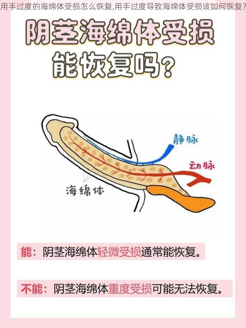 用手过度的海绵体受损怎么恢复,用手过度导致海绵体受损该如何恢复？